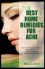 Go to record Best home remedies for acne : your total guide to natural ...
